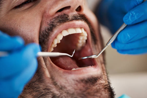 Emergency Dental Services in Wyomissing, PA